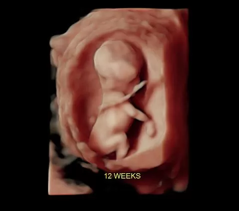 Follow-up baby ultrasound Miami