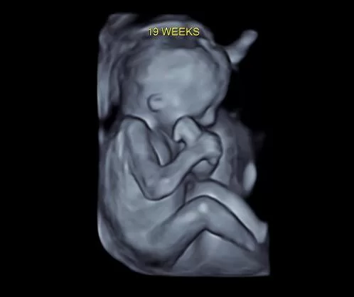 Gender reveal plus ultrasound Miami