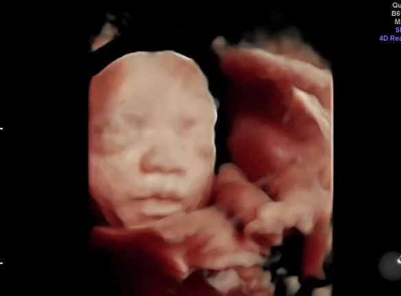 Basic 2D 3D HD ultrasound Miami