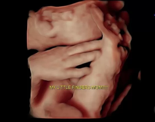 Signature Complete ultrasound Miami