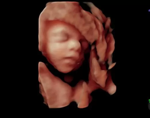 Premium 3D 4D HD Live ultrasound Miami